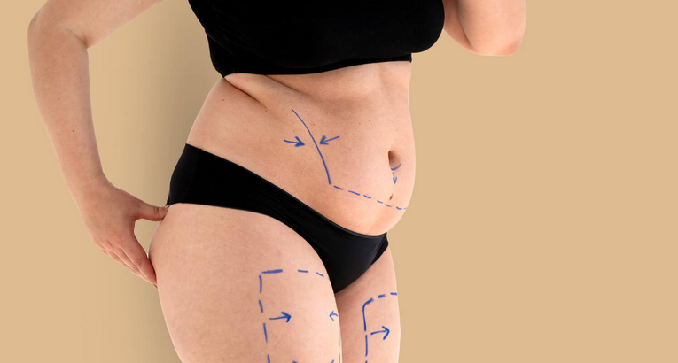 Alimentazione per aumentare il volume dei glutei