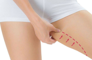 lifting microchirurgico delle braccia