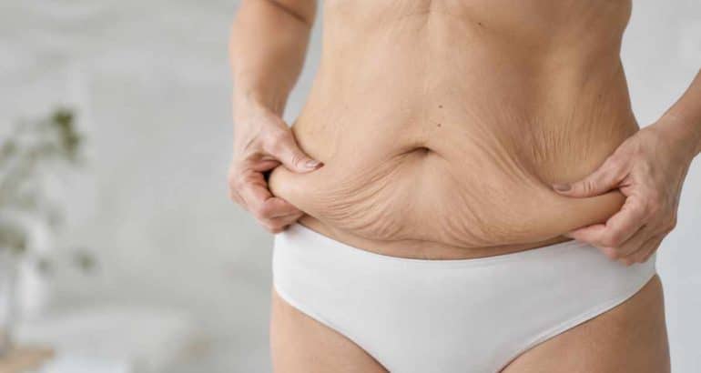 Liposuzione