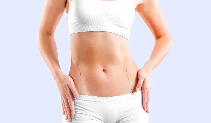 Thigh lift after weight loss