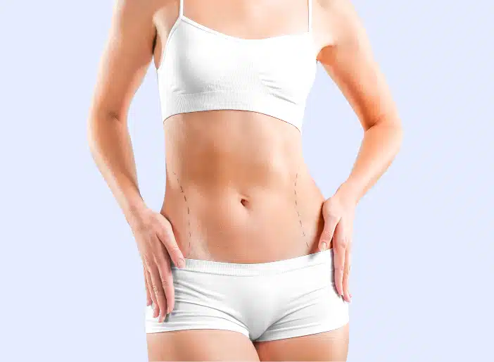 Thigh lift after weight loss